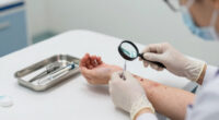 A Rare Manifestation of Mycobacterium kansasii as a Cutaneous Infection: A Case Report